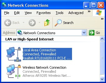 Network-connection podešavanje local area connection